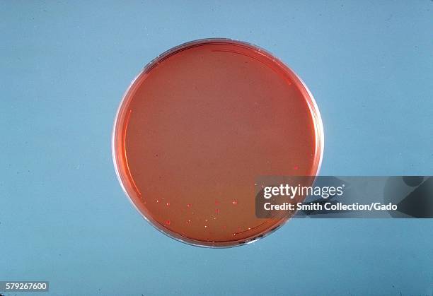 This is a SS agar plate culture of Enterobacter sakazakii after 24 hours of growth at 36C, 1978. Enterobacter sakazakii, a gram-negative, rod-shaped...