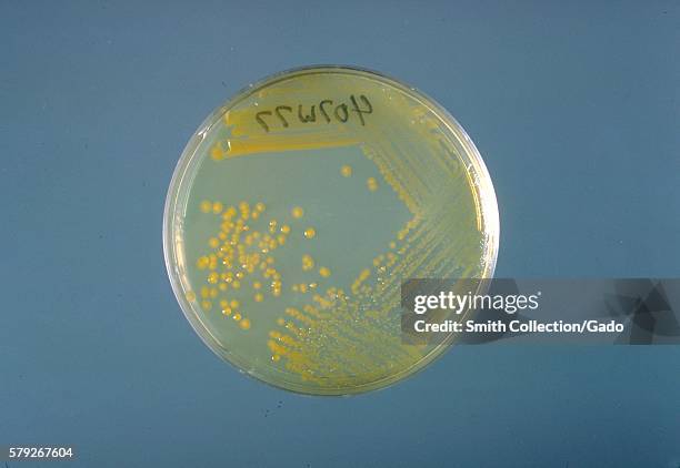 This is a trypticase soy agar plate culture of Enterobacter sakazakii after three days of growth at 25° C, 1978. Enterobacter sakazakii, a...