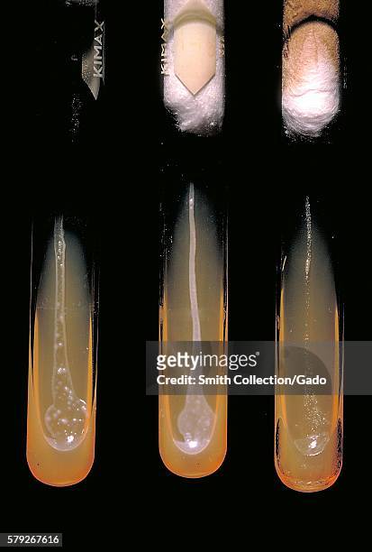 These slant cultures growing Actinomyces viscosus, reveal the oxygen requirements of this bacterium, 1971. Each culture represents the following...