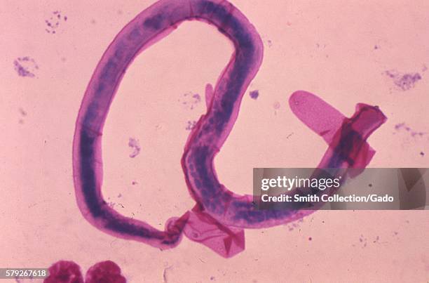 Under a magnification of 1000X, this Giemsa-stained photomicrograph microfilarial-staged nematodal parasite, Brugia pahangi, 1977. Brugia pahangi is...