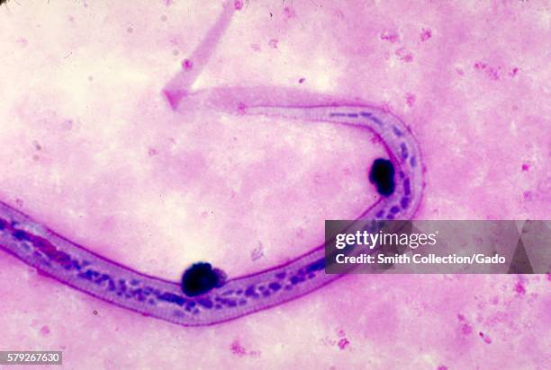 This is a micrograph of the posterior end of a Wuchereria bancrofti microfilaria in blood smear using Giemsa stain, 1977. W. Bancrofti, the most...