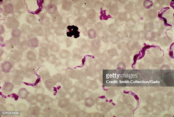 This is a micrograph of a rat blood smear revealing Trypanosoma brucei parasites using a Giemsa stain technique, 1977. African trypanosomiasis, or...