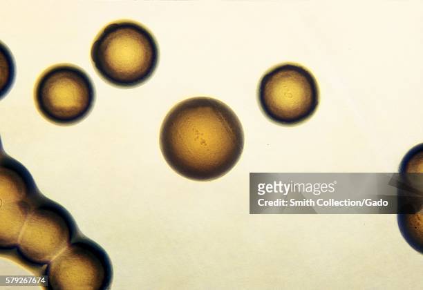 Photomicrograph of Neisseria gonorrhoeae colonies growing on GC base media with IsoVitalex after 24 hours, 1972. N. Gonorrhoeae, a gram-negative...