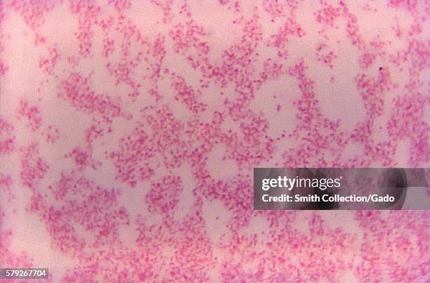 Photomicrograph of Francisella tularensis using a Safranin stain, Magnified 1000X, 1972. The bacterium F. Tularensis is considered to be a dangerous...