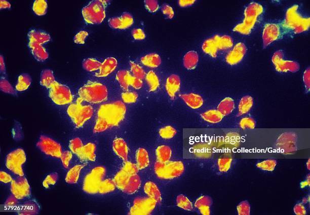 Photomicrograph of a positive indirect immunofluorescence test checking for the presence of Giardia lamblia, 1978. Giardia lamblia is the protozoan...