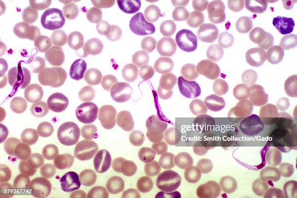 Photomicrograph of a rat blood smear revealing Trypanosoma lewisi parasites, using a Giemsa stain technique, 1977. The parasite Trypanosoma lewisi is...