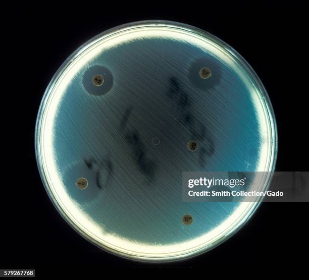 Here E. Faecalis bacteria are being cultured on an agar plate during a drug-sensitivity test in an anaerobic environment, 1972. Enterococcus...