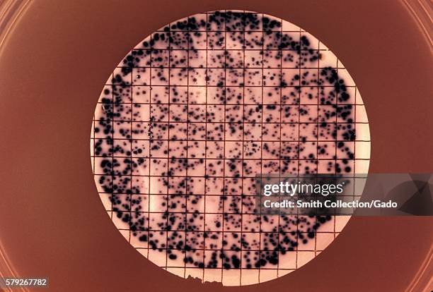 Note the presence of bacterial colonies grown from a urine specimen taken for a differential diagnostic test for gonorrhea, 1972. A urine specimen is...