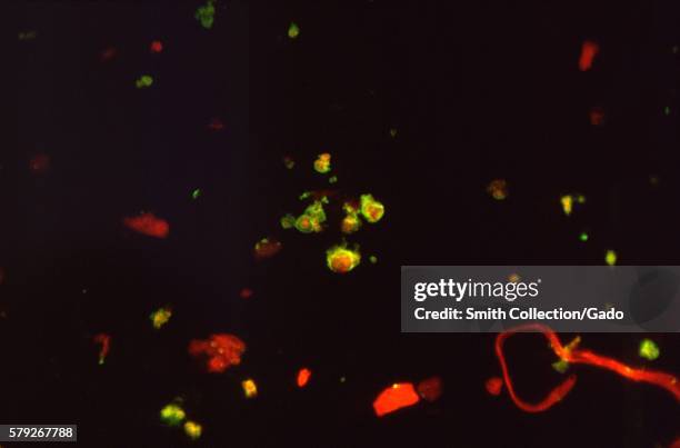 Under a magnification of 560X, this photomicrograph showing the presence of Pneumocystis jirovecii, formerly known as Pneumocystis carinii fungal...