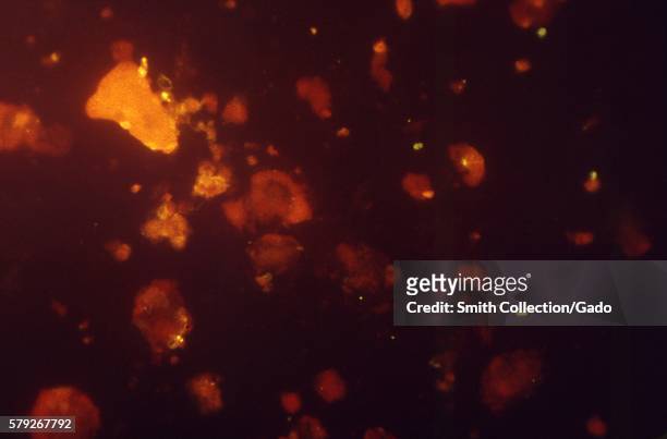 Magnified 560X, this photomicrograph showed the presence of Pneumocystis jirovecii, formerly known as Pneumocystis carinii fungal organisms using an...