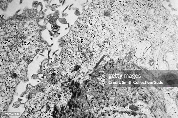 Electronmicrograph shows a thin section containing the Ebola virus, the causative agent for African Hemorrhagic Fever, 1977. The incubation period...