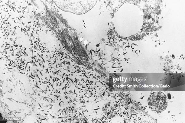 Electronmicrograph shows a thin section containing the Ebola virus, the causative agent for African hemorrhagic fever, 1976. The incubation period...