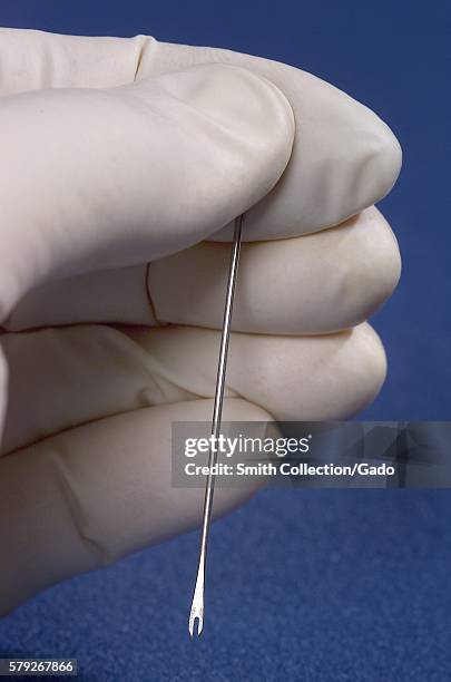 Smallpox Hand Image Smallpox Hand Photos and Premium High Res Pictures - Getty Images