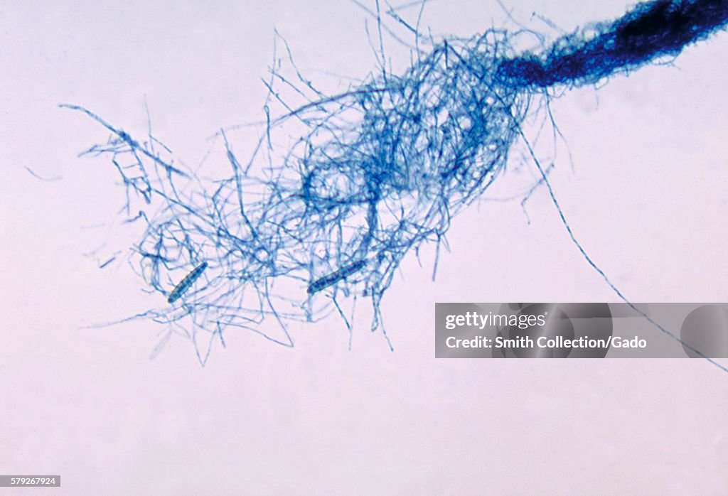 Microsporum Cookei