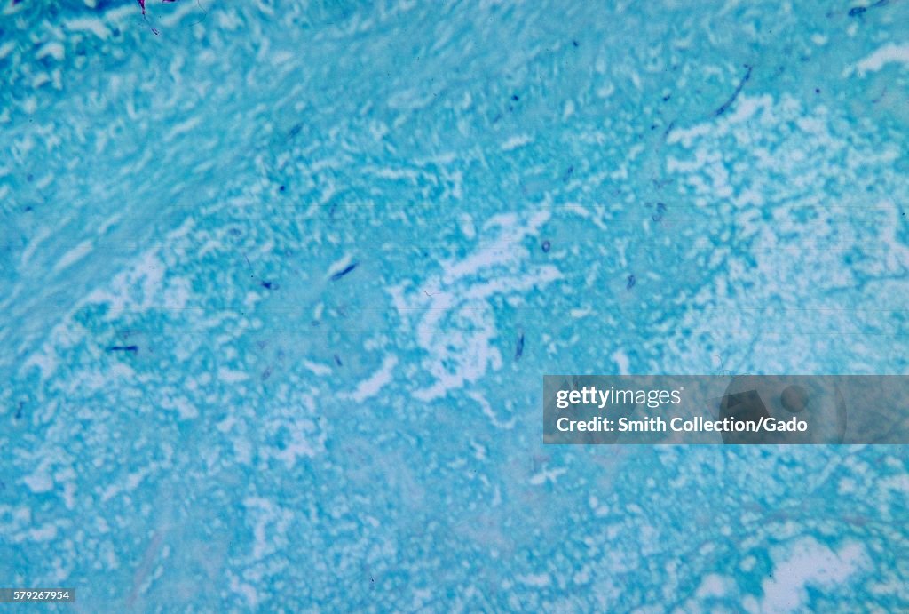 Methenamine Silver Stain
