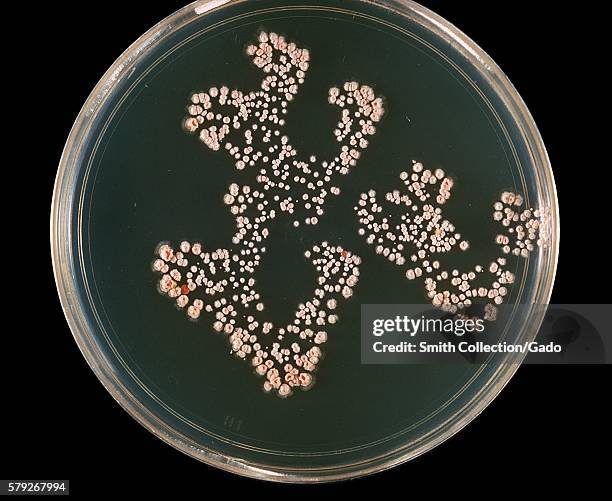 This is a plate culture of the bacteria Nocardia asteroides grown on 7H10 agar plates at 37° C, 1969. The bacterial complex Nocardia asteroids is a...