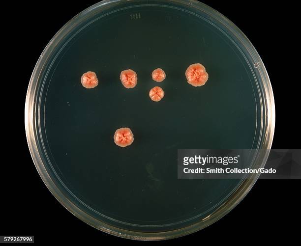This is a plate culture of the bacteria Nocardia asteroides grown on 7H10 agar medium at 37° C, 1969. The bacterial complex Nocardia asteroids is a...