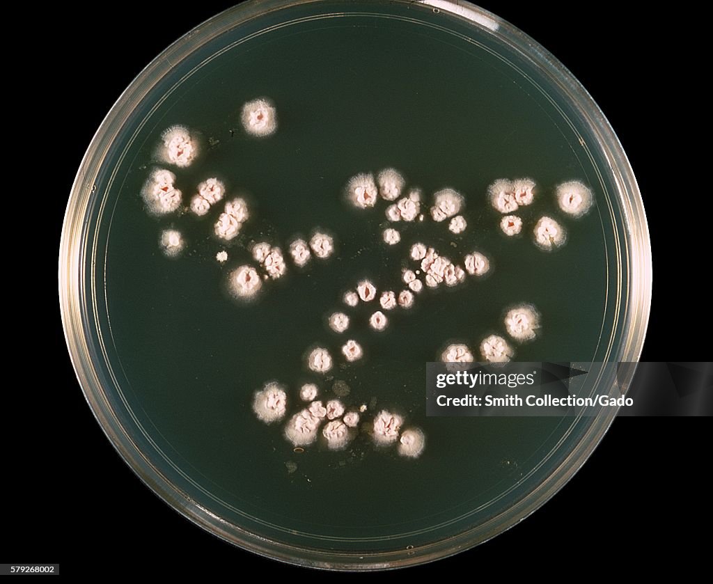 Nocardia Asteroides