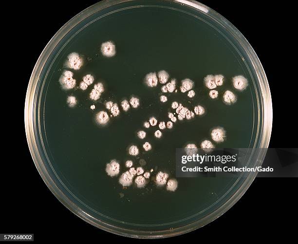 This is a plate culture of the bacteria Nocardia asteroides grown on 7H10 agar medium at 37° C, 1969. The bacterial complex Nocardia asteroids is a...