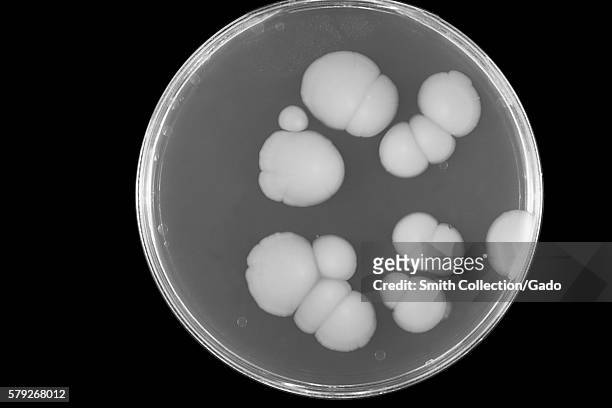 This is an image of a SABHI agar plate culture of the fungus Candida albicans grown at 20°C, 1969. Candida albicans lives in or on numerous parts of...
