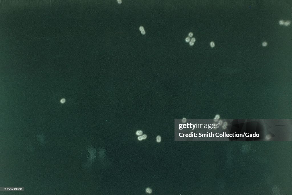 Streptococcus Pneumoniae