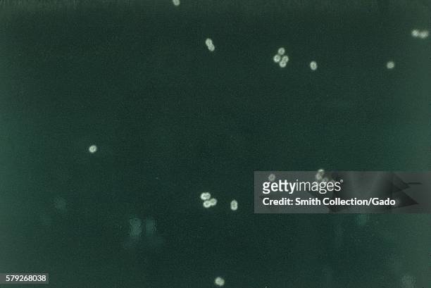 This micrograph depicts Streptococcus pneumoniae bacteria in cerebral spinal fluid using FA staining technique, 1964. The bacterium Streptococcus...