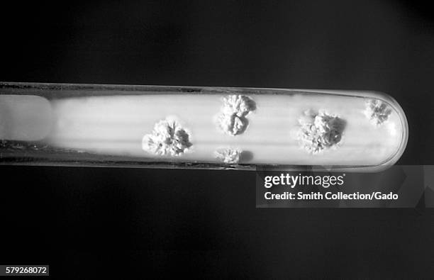 Pictured is a Lowenstein-Jensen Slant culture of Nocardia asteroids at 37°C, 1969. The bacterial complex Nocardia asteroids is a serious threat to...