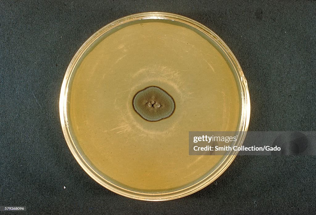 Cladosporium Carrionii