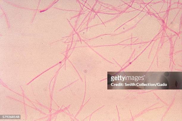 This micrograph depicts the gram-negative bacterium, Fusobacterium fusiforme cultured in blood agar for 48 hours, 1973. F. Fusiforme, along with the...