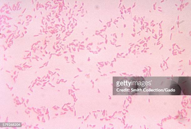 This micrograph depicts Bacteroides fragilis ss fragilis bacteria cultured in blood agar medium for 48 hours, 1972. Gram-negative B. Fragilis, though...