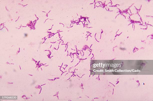 This micrograph depicts the gram-positive bacterium Bifidobacterium eriksonii, 1972. B. Eriksonii, also called Actinomyces eriksonii, is an anaerobic...