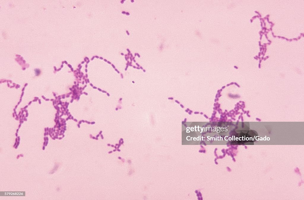 Peptostreptococcus