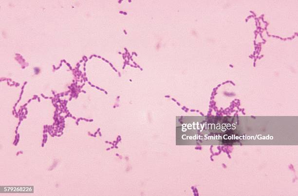 This micrograph depicts gram-positive Peptostreptococcus spp. Bacteria, which are known to grow in chain formations, 1972. Peptostreptococcus spp....