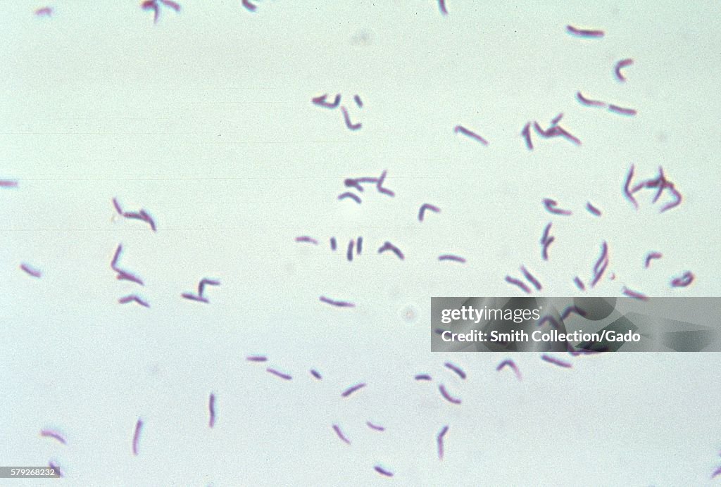 Eubacterium Alactolyticum