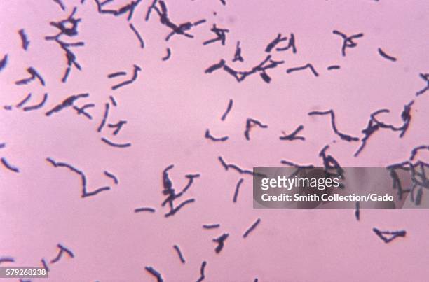 This micrograph depicts the gram-positive bacterium Bifidobacterium eriksonii grown in thioglycollate medium at 48 hours, 1972. B. Eriksonii, also...