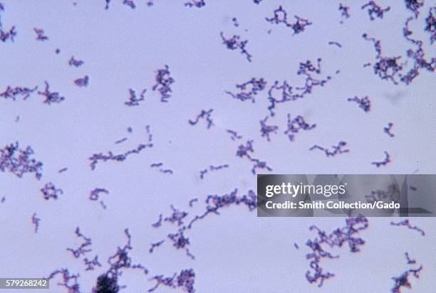 This micrograph depicts the gram-positive bacterium Propionibacterium acnes grown in thioglycollate medium at 48 hours, 1972. Propionibacterium acnes...