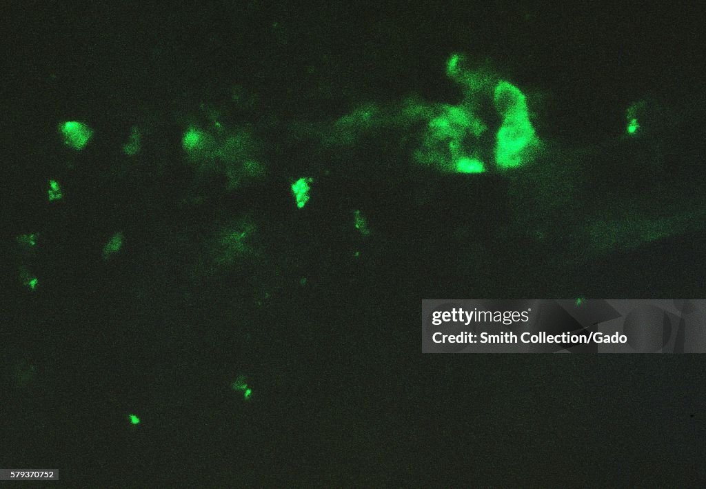 Chick Chorioallantoic Membrane