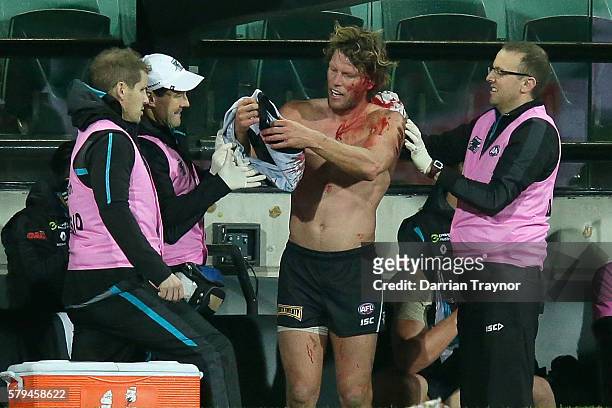 Brad Ebert of the Power is helped by mediacal staff during the round 18 AFL match between the Port Adelaide Power and the Greater Western Sydney...