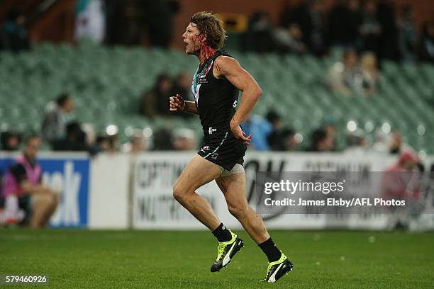 Brad Ebert of the Power goes off with blood during the 2016 AFL Round 18 match between Port Adelaide Power and the GWS Giants at the Adelaide Oval on...