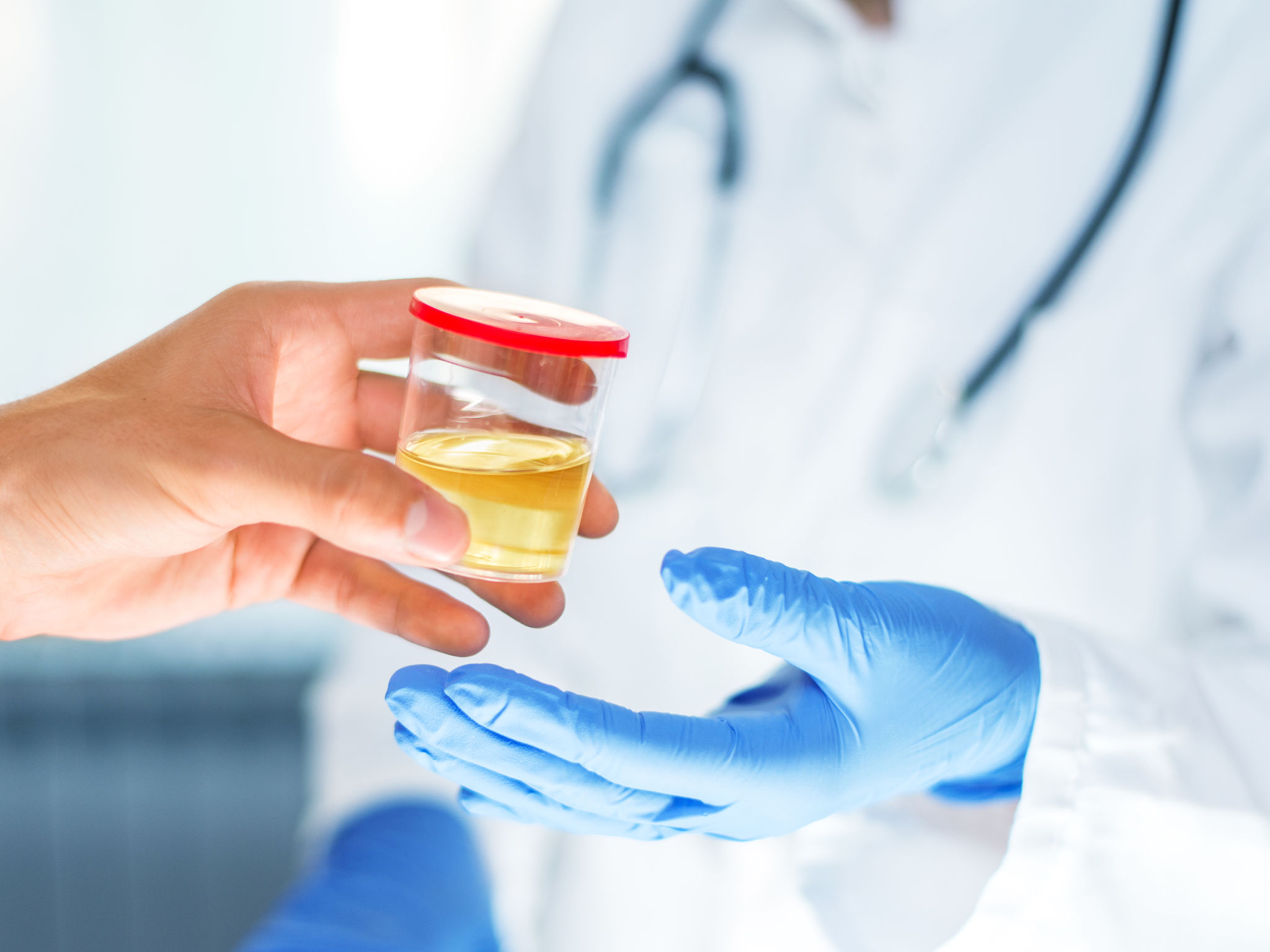 urine testing