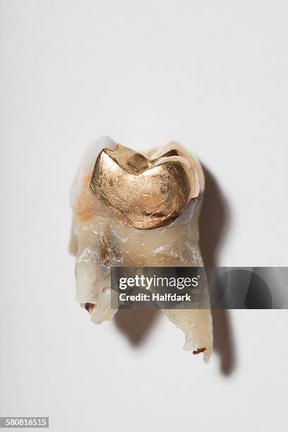 close-up of gold tooth on white background - corona de oro fotografías e imágenes de stock