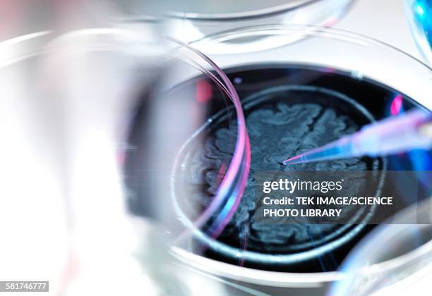 dementia research - 3d scanning stock illustrations