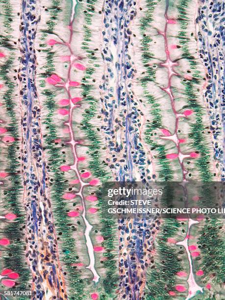 small intestine, light micrograph - villus stock pictures, royalty-free photos & images