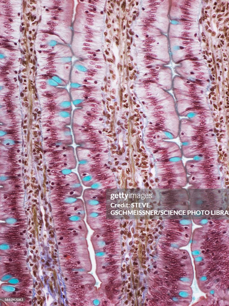 Small intestine, light micrograph