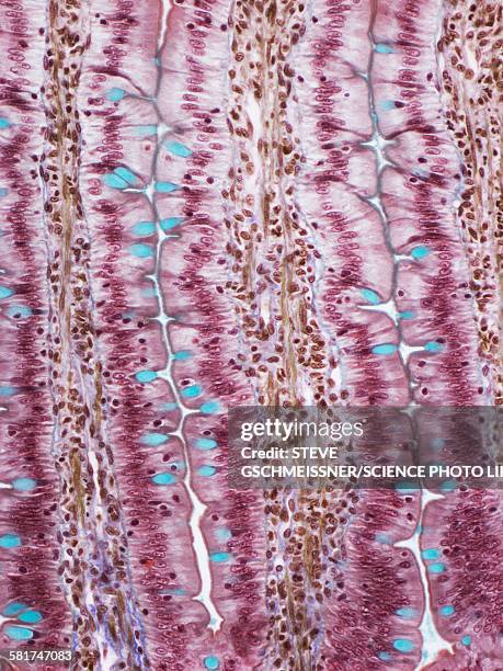 small intestine, light micrograph - duodenum micrograph stock pictures, royalty-free photos & images