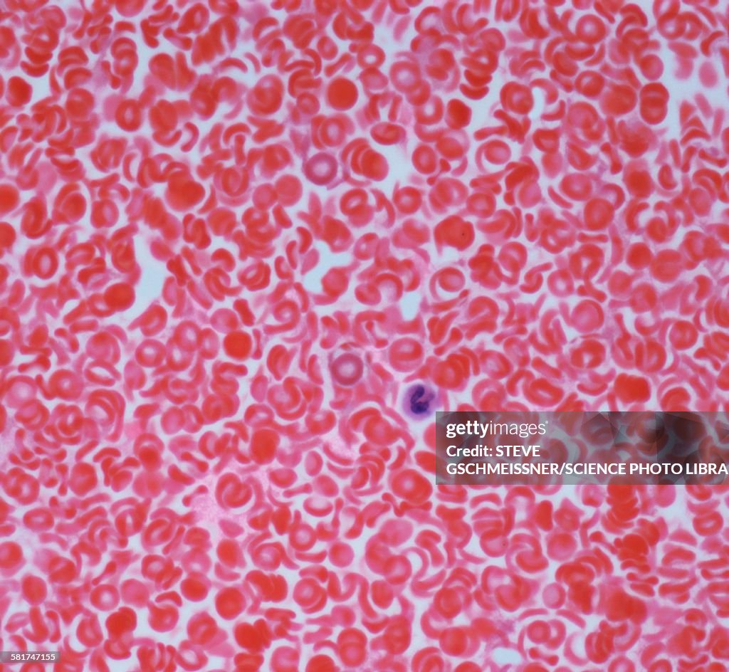 Blood, light micrograph