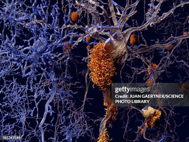 ilustraciones, imágenes clip art, dibujos animados e iconos de stock de brain nerve cells affected by alzheimers - enfermedad de alzheimer