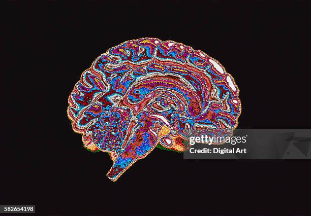 cross-section of brain - brain scan stock-fotos und bilder