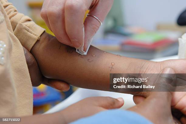 allergy test - test allergologico foto e immagini stock