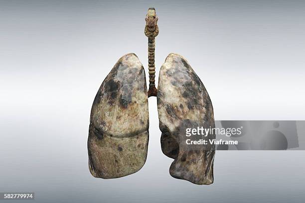 smoker's lung - human lung stock pictures, royalty-free photos & images